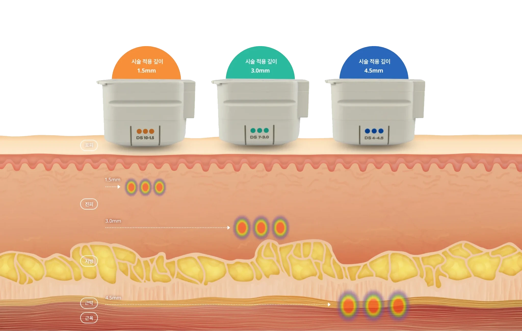 1.5·3.0·4.5mm 카트리지가 표피·진피·지방·근막(SMAS)층까지 깊이별로 초음파 에너지를 전달하는 피부 단면 도식